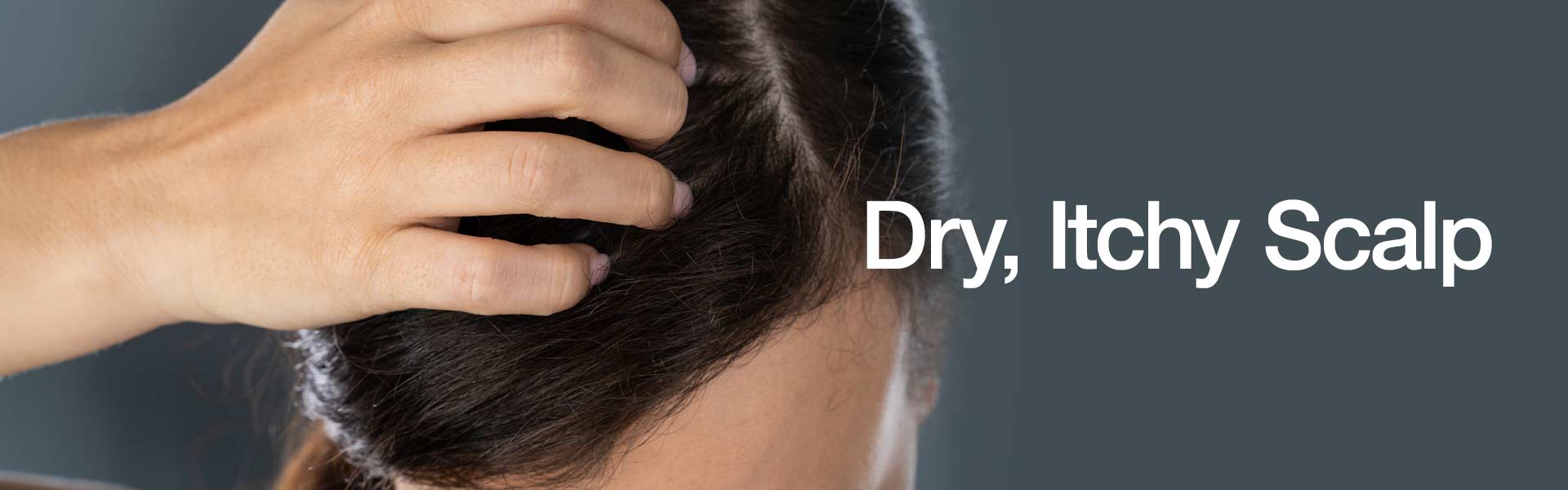 Dry, Itchy Scalp