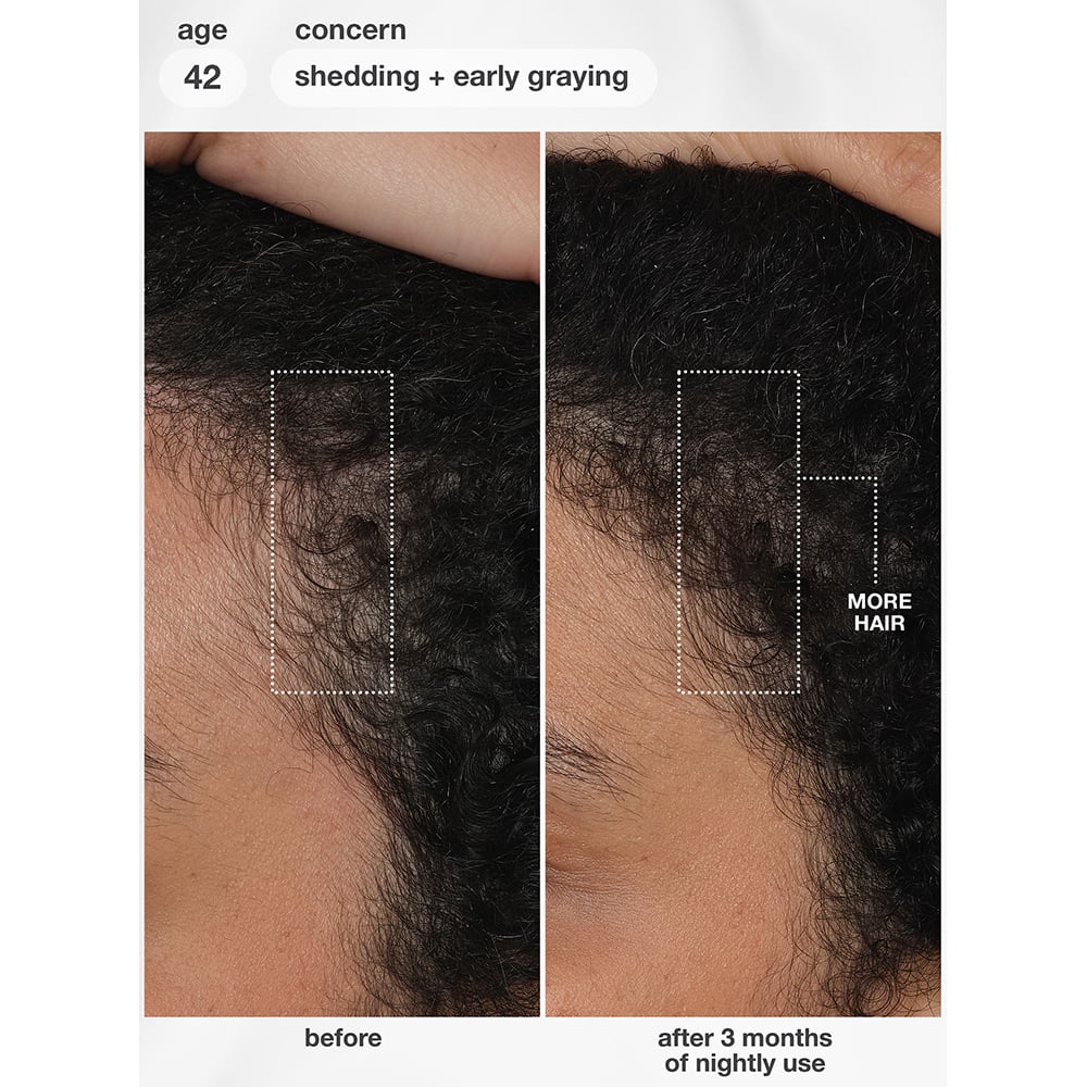 K18 FutureIQ™ Biomimetic Hair Longevity Serum, 90ml - Image 13
