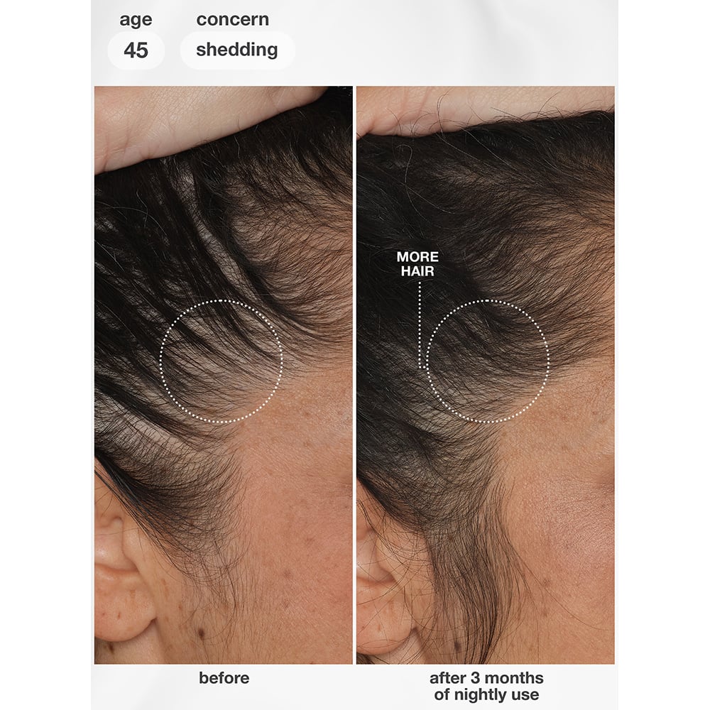 K18 FutureIQ™ Biomimetic Hair Longevity Serum, 90ml - Image 14