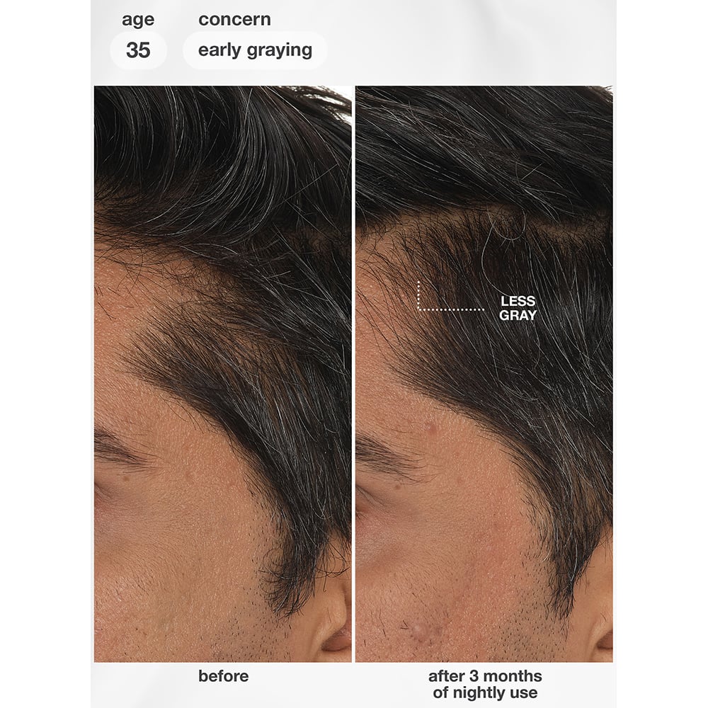 K18 FutureIQ™ Biomimetic Hair Longevity Serum, 90ml - Image 16