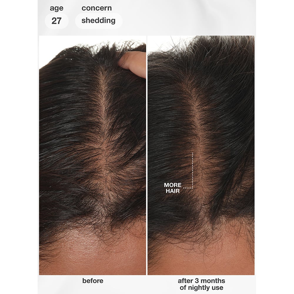 K18 FutureIQ™ Biomimetic Hair Longevity Serum, 90ml - Image 10