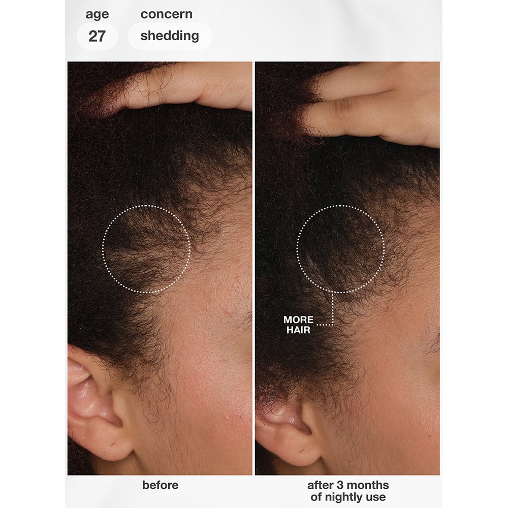 K18 FutureIQ™ Biomimetic Hair Longevity Serum, 90ml - Image 11